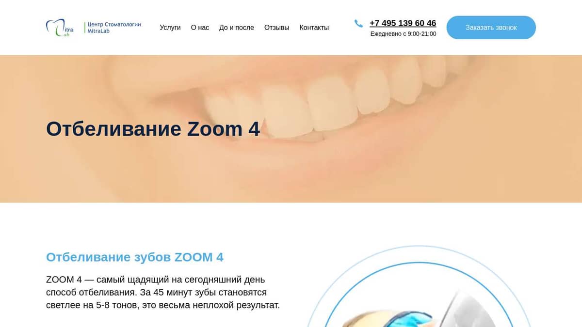 Отбеливание Zoom 4