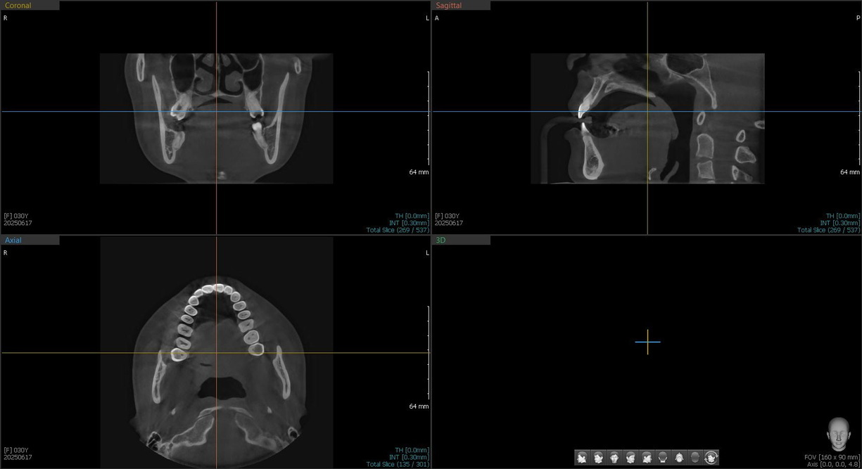 Компьютерная томография (КТ) - Фото