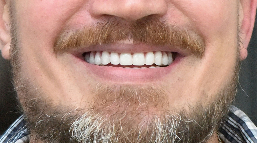 photo after