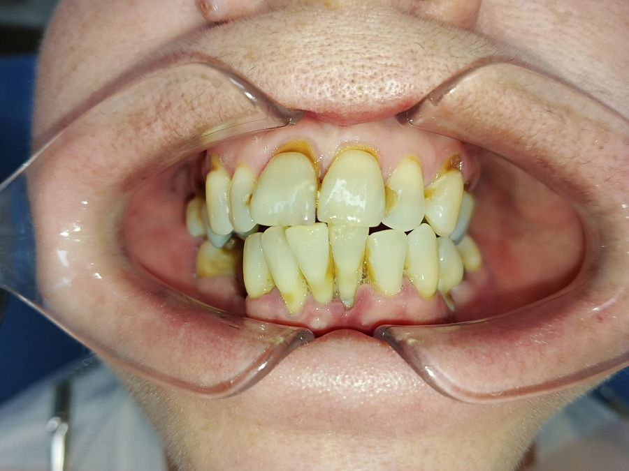 photo before