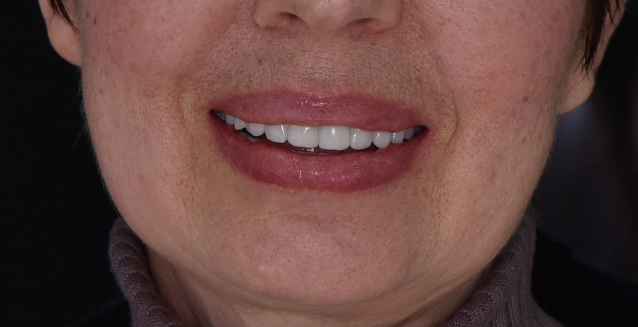 photo after