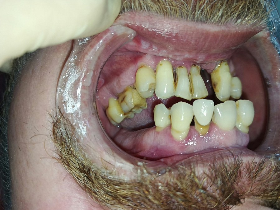 photo before
