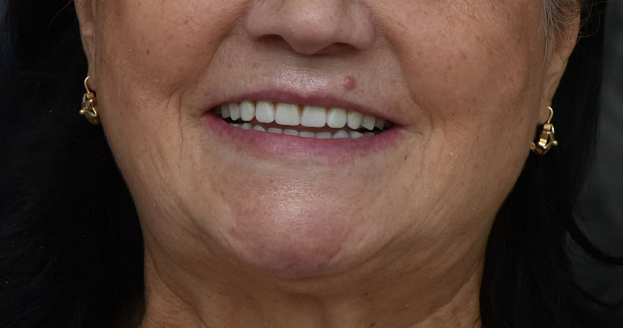 photo after